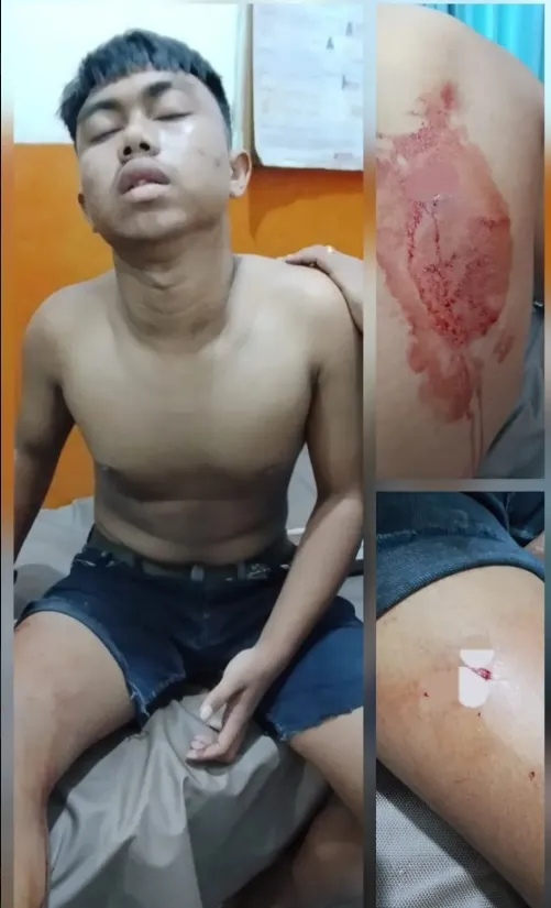 Hendak Beli Rokok, Remaja 16 Tahun Diduga Jadi Korban Salah Sasaran Tawuran di Deliserdang