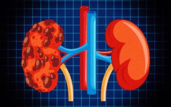 Penyebab Gagal Ginjal Di Usia Muda, Faktor Risiko dan Gaya Hidup Qaplo